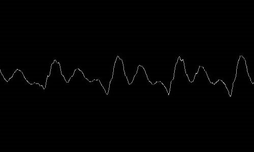 P2P Waveform Preview